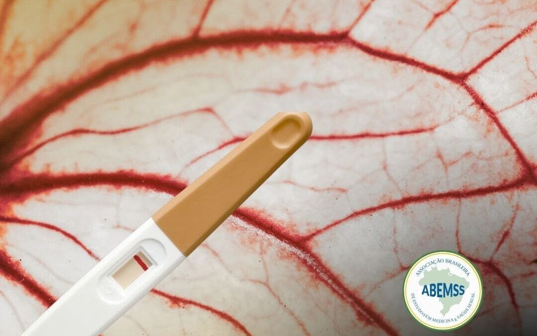 Varicocele e fertilidade o que realmente muda