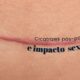 Cicatrizes pós-parto e impacto sexual