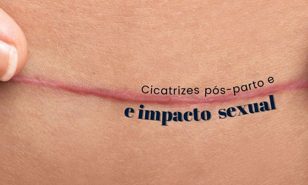 Cicatrizes pós-parto e impacto sexual