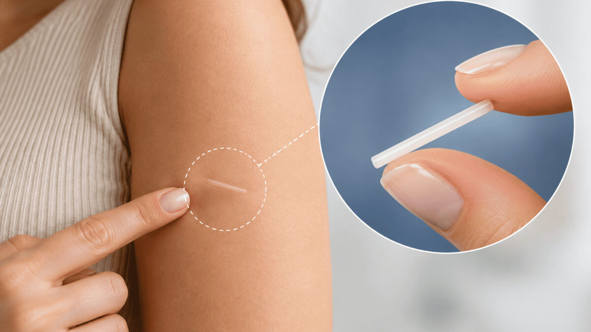 Implantes hormonais