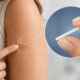 Implantes hormonais